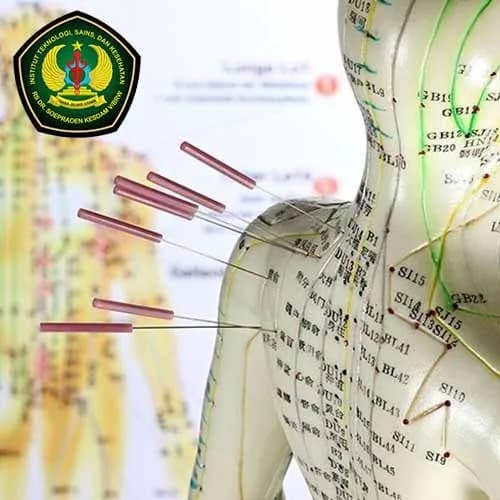 Kegiatan pembelajaran program studi D3 Akupunktur